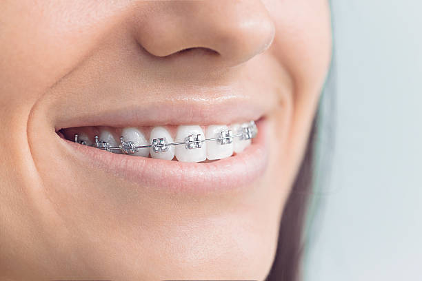 Full Mouth Reconstruction in Havre De Grace, MD